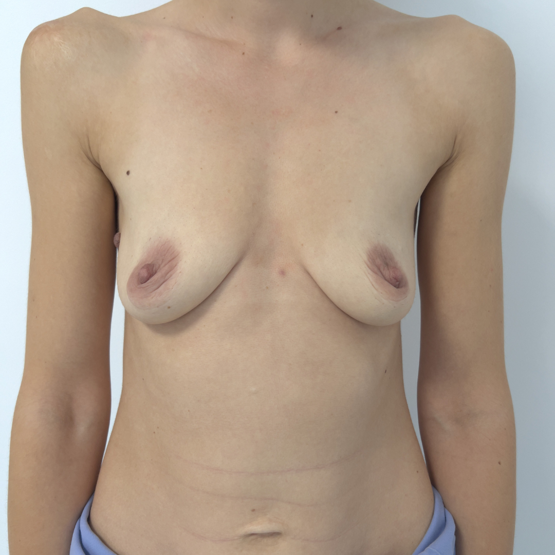 Case 1 Image 3