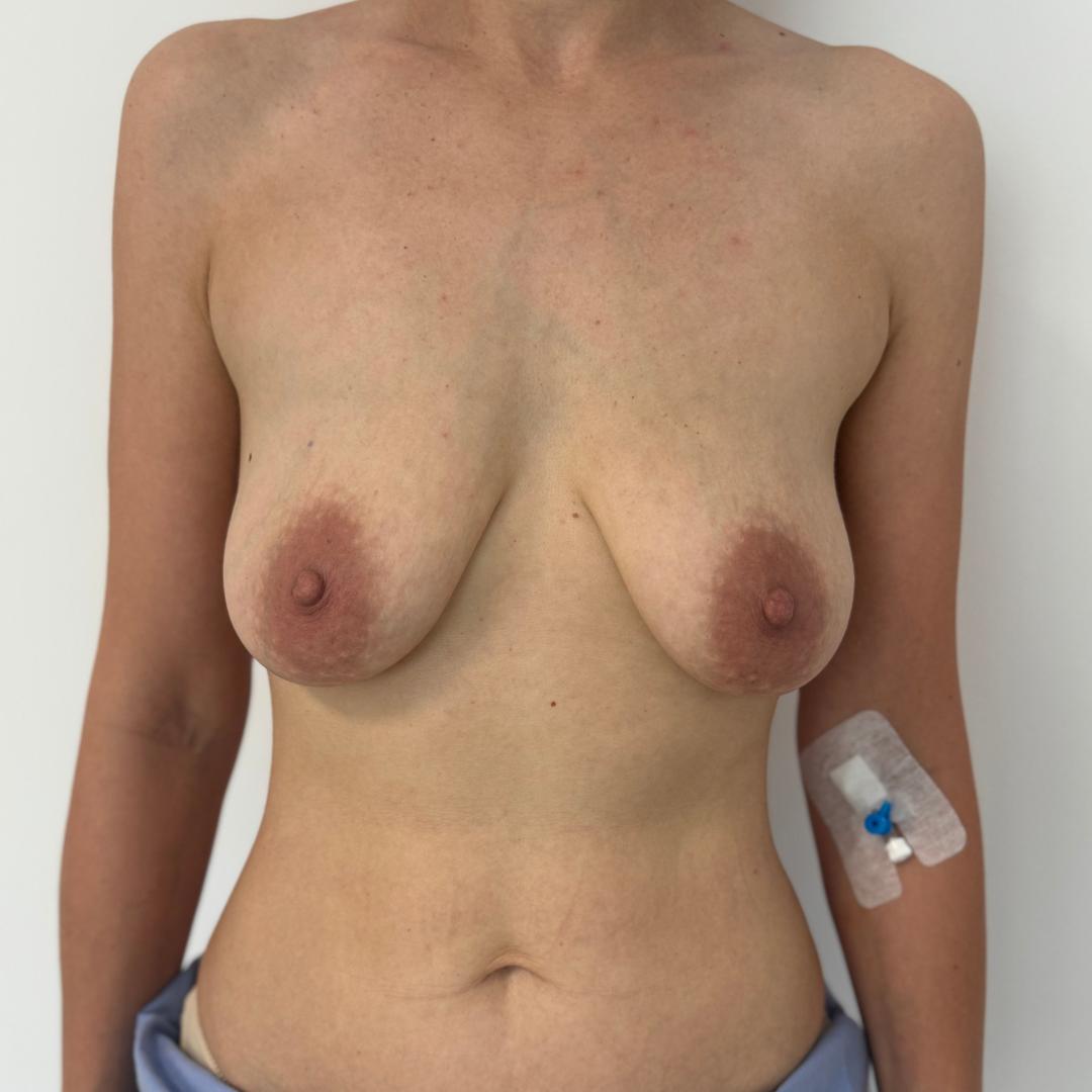 Case 2 Image 3